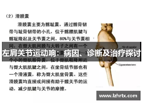 左肩关节运动响：病因、诊断及治疗探讨